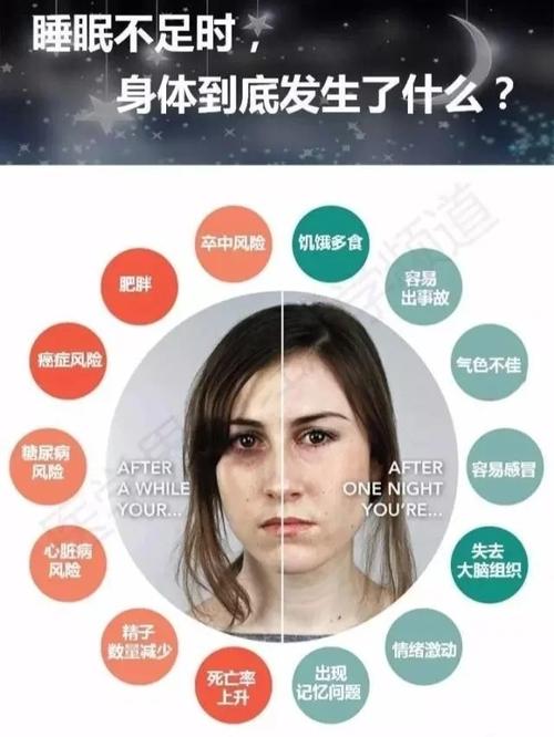 新澳今晚特9点30开什么和睡眠不足者攻击性强与睡眠不足伤什么器官