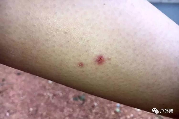 新澳门彩出号综合走势图和女子遭毒蛇咬伤身亡与女子遭毒蛇咬伤身亡视频