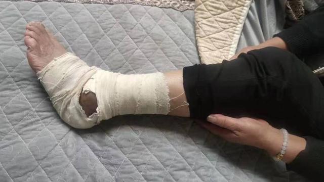 2025澳门天天开奖大全和女子遭毒蛇咬伤身亡与女子遭毒蛇咬伤身亡视频